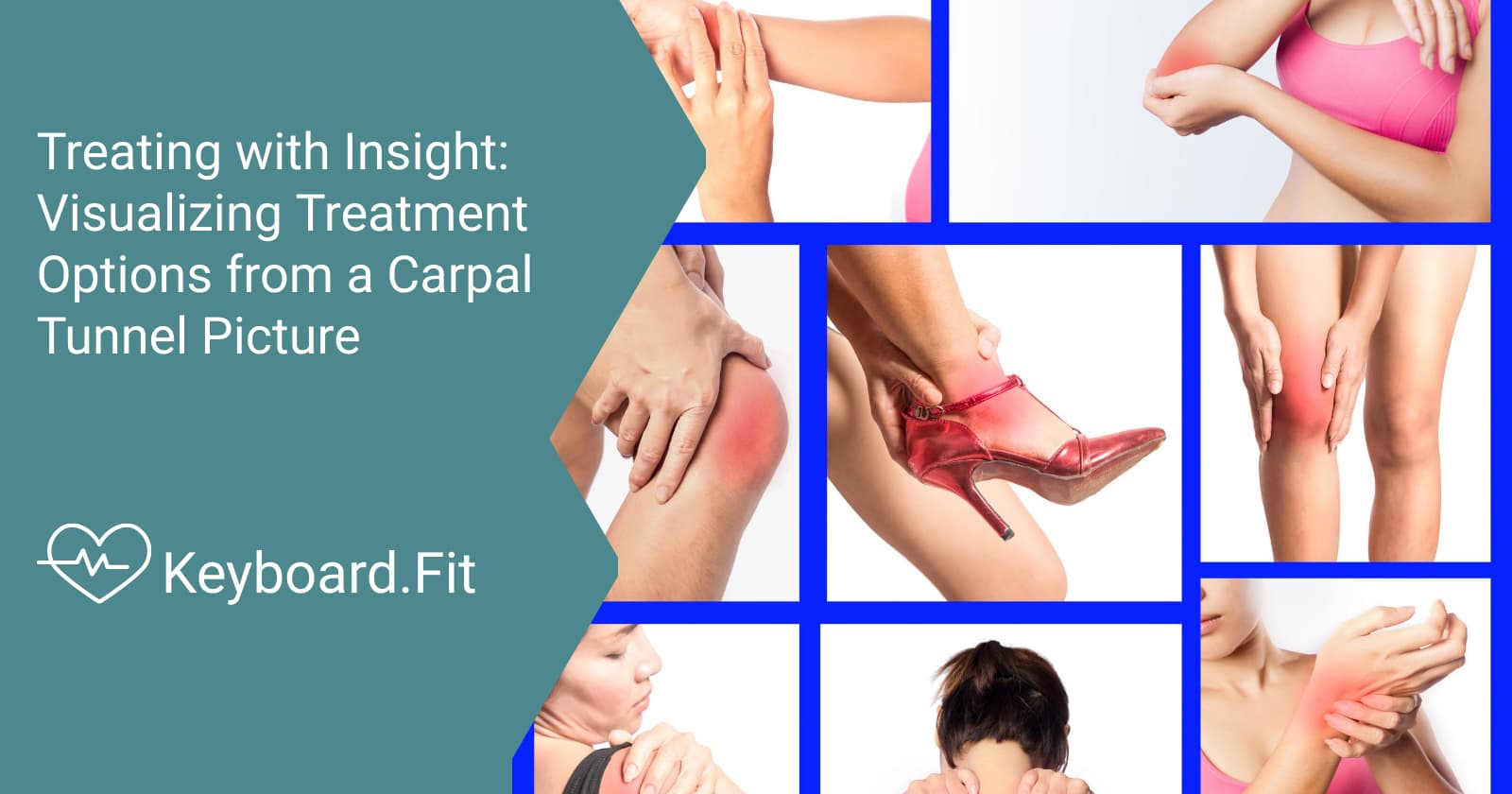 Treating with Insight Visualizing Treatment Options from a Carpal