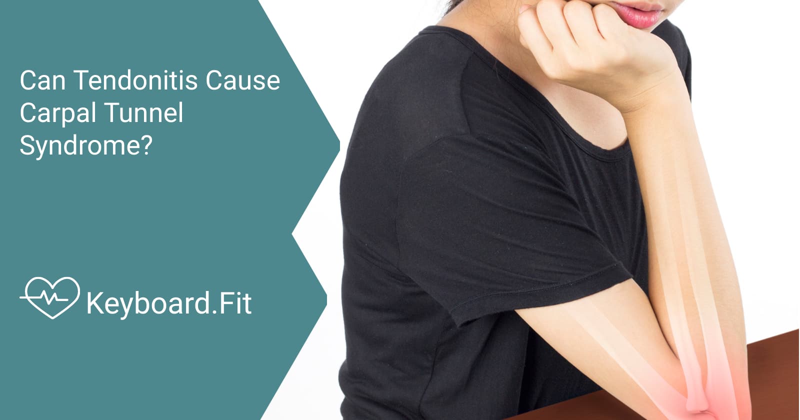 Can Tendonitis Cause Carpal Tunnel Syndrome? Keyboard.Fit